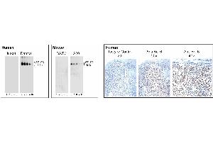 Analysis of Bcl-6 expression by Western blot and Immunohistochemistry. (BCL6 Antikörper)