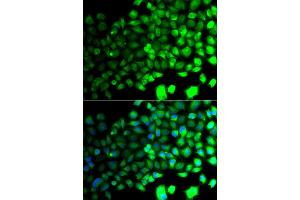 Immunofluorescence analysis of A549 cell using PRKAA2 antibody. (PRKAA2 Antikörper)