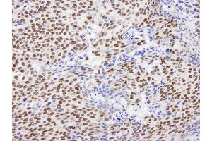 Immunohistochemistry (IHC) image for anti-General Transcription Factor III (GTF2I) (C-Term) antibody (ABIN7448970) (GTF2I Antikörper  (C-Term))