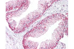 Anti-AURKA / Aurora-A antibody IHC of human prostate. (Aurora A Antikörper  (C-Term))