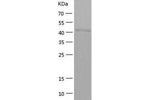 Legumain (LGMN) (AA 18-433) protein (His-IF2DI Tag)