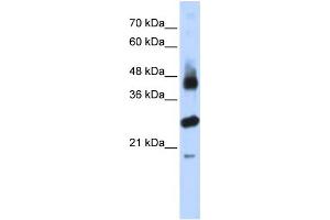WB Suggested Anti-FBXL2 Antibody Titration:  0. (FBXL2 Antikörper  (N-Term))