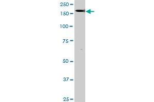 Western Blotting (WB) image for anti-TEK Tyrosine Kinase, Endothelial (TEK) (AA 66-185) antibody (ABIN793004) (TEK Antikörper  (AA 66-185))