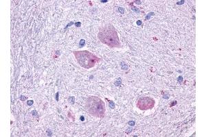 Immunohistochemical staining of Brain (Neurons and glia) using anti- CHRM4 antibody ABIN122327 (CHRM4 Antikörper)