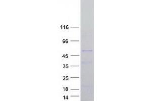 Western Blotting (WB) image for NADPH Oxidase Organizer 1 (NOXO1) (Transcript Variant C) protein (Myc-DYKDDDDK Tag) (ABIN2727494)