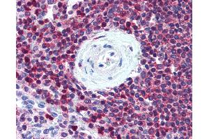 Anti-SLC9A3R1 / NHERF1 antibody IHC of human spleen. (SLC9A3R1 Antikörper)