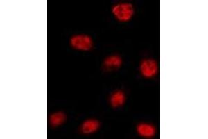 ABIN6275321 staining 293T by IF/ICC. (NCOA7 Antikörper  (Internal Region))