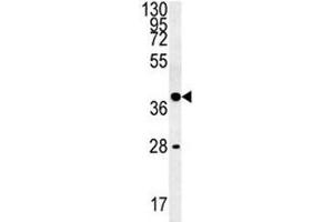 Western Blotting (WB) image for anti-Wingless-Type MMTV Integration Site Family, Member 8B (WNT8B) (AA 323-351) antibody (ABIN3029638)