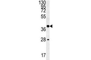 WNT8B antibody western blot analysis in K562 lysate (WNT8B Antikörper  (AA 323-351))