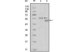 Western blot analysis using EphA6 mouse mAb against truncated MBP-EphA6 recombinant protein (1) and truncated GST-EphA6(aa695-795) recombinant protein (2). (EPH Receptor A6 Antikörper)