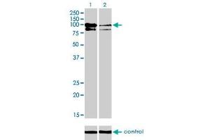Western blot analysis of OCRL over-expressed 293 cell line, cotransfected with OCRL Validated Chimera RNAi (Lane 2) or non-transfected control (Lane 1). (OCRL Antikörper  (AA 146-239))