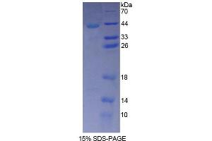 SDS-PAGE analysis of Human TUBa3C Protein. (TUBA3C Protein)