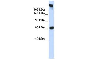 WB Suggested Anti-SI Antibody Titration:  0. (SI Antikörper  (N-Term))