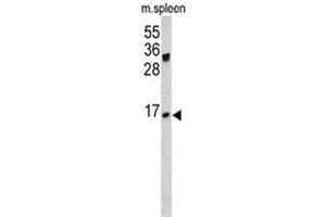 Western blot analysis of IGJ antibody (N-term) in mouse spleen lysates (35ug/lane). (Kaninchen anti-Human Immunoglobulin J Polypeptide, Linker Protein For Immunoglobulin alpha and mu Polypeptides (IGJ) (Joining Chain), (N-Term) Antikörper)