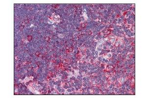 Image no. 1 for anti-Tumor Necrosis Factor Receptor Superfamily, Member 10a (TNFRSF10A) (AA 1-20), (N-Term) antibody (ABIN303303)