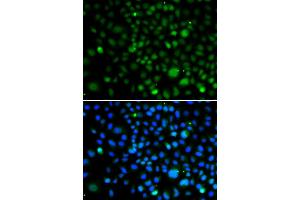Immunofluorescence analysis of A549 cells using KLF15 antibody. (KLF15 Antikörper)