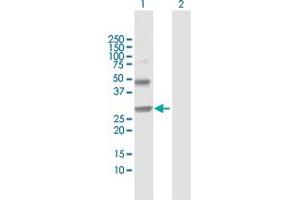 Western Blot analysis of NOG expression in transfected 293T cell line by NOG MaxPab polyclonal antibody. (NOG Antikörper  (AA 1-232))