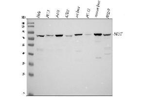 Western blot analysis of MUT using anti-MUT antibody (ABIN4886676).