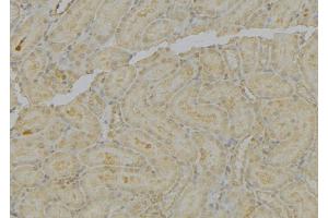 ABIN6279587 at 1/100 staining Mouse kidney tissue by IHC-P.