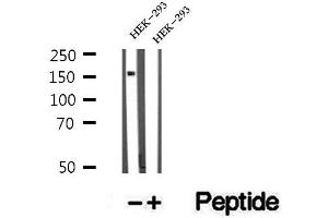 Western blot analysis of extracts of HEK-293 cells, using ZFYVE16 antibody. (ZFYVE16 Antikörper  (C-Term))