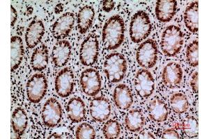 Immunohistochemistry (IHC) analysis of paraffin-embedded Human Colon, antibody was diluted at 1:100. (CACYBP Antikörper  (C-Term))