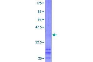 CHIC2 Protein (AA 1-165) (GST tag)