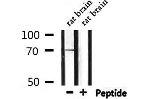 Western blot analysis of extracts from rat brain, using PROS1 Antibody. (PROS1 Antikörper  (N-Term))