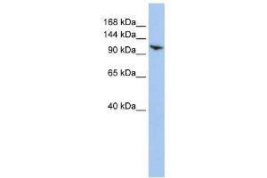 Western Blotting (WB) image for anti-Ring Finger Protein 20 (RNF20) antibody (ABIN2458728) (RNF20 Antikörper)