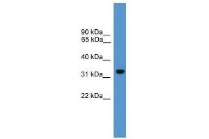 Western Blot showing BNIP1 antibody used at a concentration of 1-2 ug/ml to detect its target protein. (BNIP1 Antikörper  (N-Term))