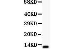 Observed bind size: 12KD (TFF1 Antikörper  (AA 25-84))