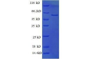 SDS-PAGE (SDS) image for Protein Kinase C Substrate 80K-H (PRKCSH) (AA 15-302), (partial) protein (GST tag) (ABIN1095608)
