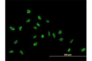 Immunofluorescence of purified MaxPab antibody to ZNF593 on HeLa cell. (ZNF593 Antikörper  (AA 1-116))