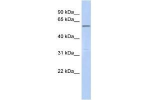 WB Suggested Anti-C6orf182 Antibody Titration: 0. (CEP57L1 Antikörper  (Middle Region))