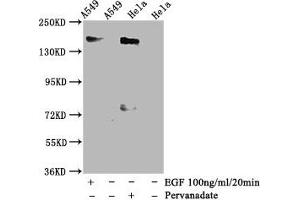 Western Blot Positive WB detected in A549 whole cell lysate,Hela whole cell lysate(treated with Pervanadate or EGF) All lanes Phospho-EGFR antibody at 1. (Rekombinanter EGFR Antikörper  (pTyr1092))