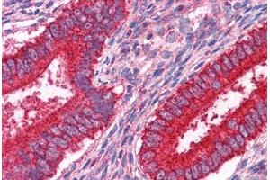 Human Uterus: Formalin-Fixed, Paraffin-Embedded (FFPE) (JUP Antikörper  (AA 1-746))