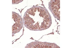 Immunohistochemistry of paraffin-embedded rat testis using NCK11 Rabbit mAb (ABIN7268834) at dilution of 1:100 (40x lens).
