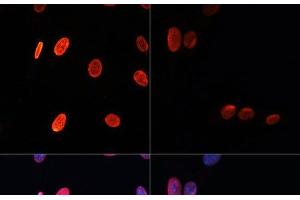 Immunofluorescence analysis of NIH/3T3 cells using Acetyl-Histone H3-K56 Polyclonal Antibody at dilution of 1:100. (Histone 3 Antikörper  (acLys56))
