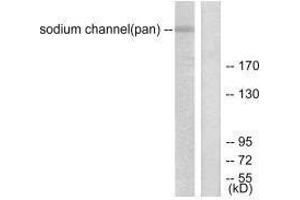 SCN5A Antikörper