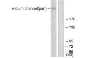 Western blot analysis of extracts from HuvEc cells, using Sodium Channel-pan antibody. (SCN5A Antikörper)