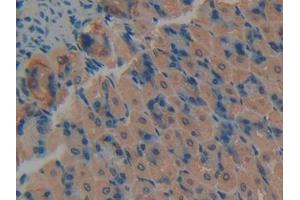 DAB staining on IHC-P; Samples: Mouse Stomach Tissue (PKC delta Antikörper  (AA 328-674))