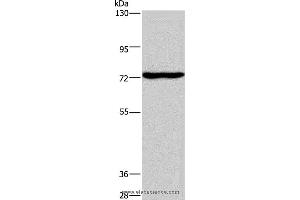 Western blot analysis of Mouse brain tissue, using KCND1 Polyclonal Antibody at dilution of 1:400 (KCND1 Antikörper)