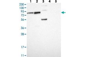 Western blot analysis of Lane 1: RT-4, Lane 2: U-251 MG, Lane 3: Human Plasma, Lane 4: Liver, Lane 5: Tonsil with PUS7 polyclonal antibody  at 1:250-1:500 dilution. (PUS7 Antikörper)