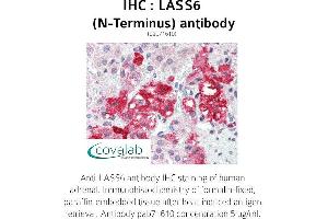 Image no. 1 for anti-Ceramide Synthase 6 (CERS6) (N-Term) antibody (ABIN1736367) (CERS6 Antikörper  (N-Term))