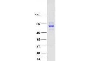 Validation with Western Blot
