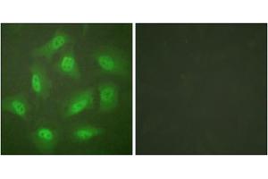 Immunofluorescence analysis of HeLa cells, treated with Forskolin (40nM, 30mins), using JAB1 antibody (ABIN5976433).
