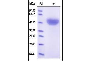 Human Serpin A1, His Tag on SDS-PAGE under reducing (R) condition. (SERPINA1 Protein (AA 25-418) (His tag))