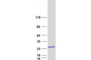 Western Blotting (WB) image for Interleukin 1 Family Member 9 (IL1F9) protein (Myc-DYKDDDDK Tag) (ABIN2723385)