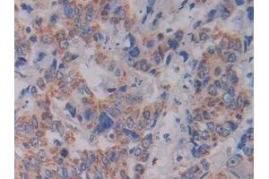 Immunohistochemistry (IHC) image for anti-serine Hydroxymethyltransferase 2 (Mitochondrial) (SHMT2) (AA 30-504) antibody (ABIN7443701)