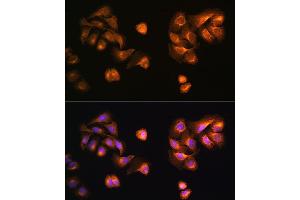 Immunofluorescence analysis of U2OS cells using COPZ1 antibody (ABIN6127709, ABIN6138892, ABIN6138893 and ABIN6215734) at dilution of 1:100.