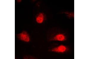 Immunofluorescent analysis of hnRNP Q staining in HeLa cells. (SYNCRIP Antikörper  (Center))